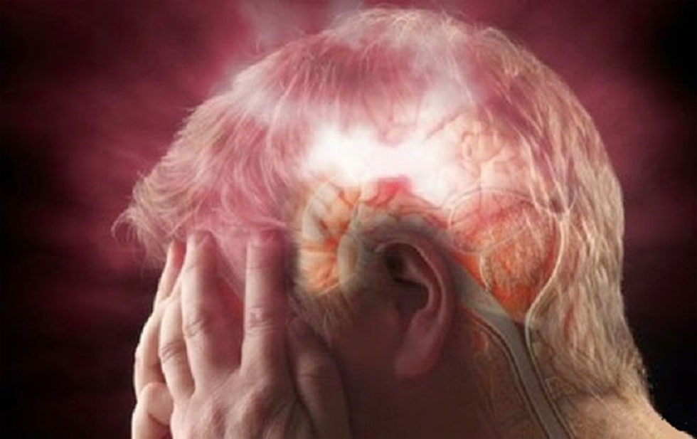 Derrame cerebral: CINCO señales que debes atender de INMEDIATO
